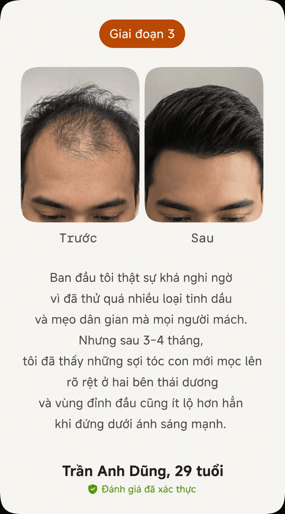 Kết quả thực tế trước và sau giai đoạn 1